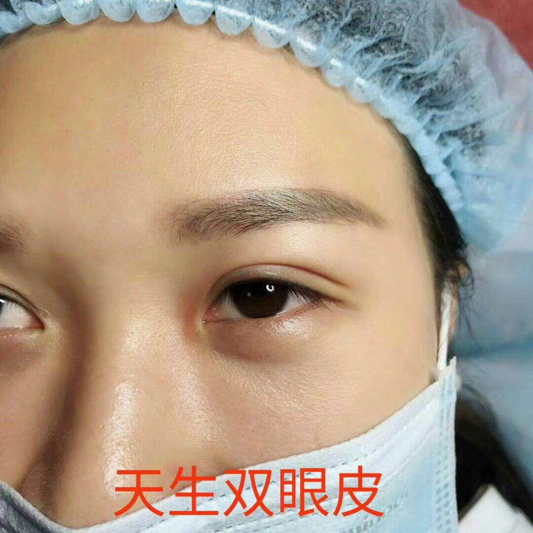 天生雙眼皮，威海以琳美容美發(fā)學(xué)校學(xué)校成就你的迷人大眼！