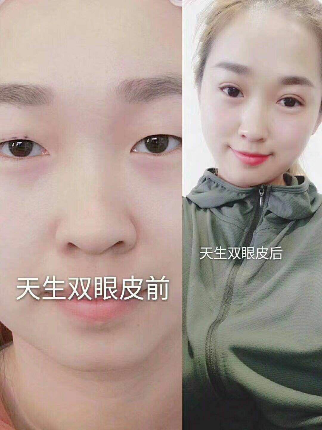 天生雙眼皮，威海以琳美容美發(fā)學(xué)校學(xué)校成就你的迷人大眼！